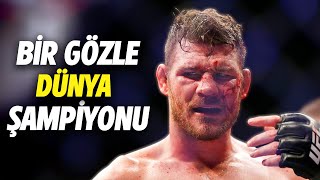 Maç Sırasında GÖZÜNÜ KAYBEDEN Dövüşcü Michael Bisping [upl. by Eicyaj765]