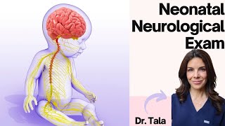 How to perform the NEURO exam on a baby HeadtoToe CNS evaluation [upl. by Nysilla]