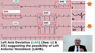 EKG Trainer Case 1 Answer internalmedicine cme usmle محاضراتباطنة ecg [upl. by Shu37]