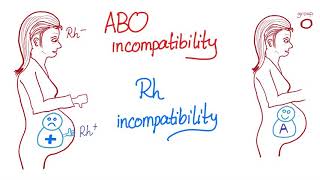 ABO incompatibility vs Rh incompatibility [upl. by Adnalra23]