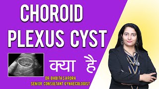 Choroid Plexus Cyst on Ultrasound explained by Gynaecologist Dr Babita S Arora [upl. by Kezer409]