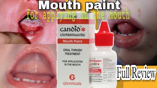 Candid Mouth Paint Uses Dosage Composition  Clotrimazole mouth paint Review [upl. by Salamone]