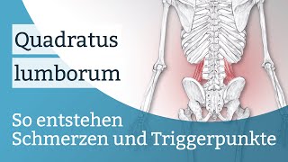 Quadratus lumborum Schmerzen Triggerpunkte und deren Aktivierung [upl. by Nessej]