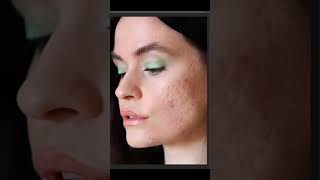 Remove Blemishes Easily Short Photoshop Tutorial blemishremoval [upl. by Fagaly]