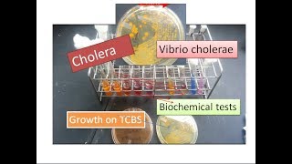 Cholera  Vibrio cholerae [upl. by Nahsed293]