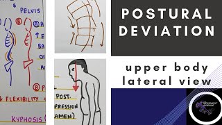 POSTURAL DEVIATION LATERAL VIEW UPPER BODY Posture BiomechanicsPhysiotherapy Tutorial [upl. by Lockwood]