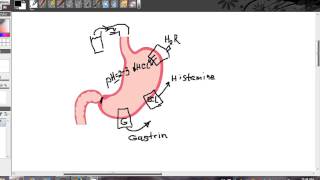 Cancer Carcinoid Tumors Risk increased by Proton pump Inhibitors Omeprozole and H2 antagonist [upl. by Wurtz248]