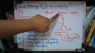 RENAL PATHOLOGY lecture 8 C3 GLOMERULOPATHY must watch to grab easily [upl. by Bertero543]