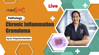 Chronic Inflammation  Granuloma with Dr Priyanka Sachdev [upl. by Brunell]