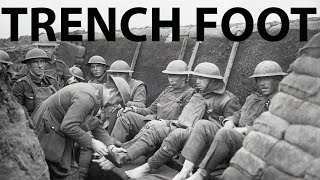 TRENCH FOOT  Trench Warfare disease [upl. by Auka]