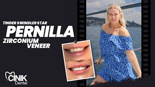 Tinder Swindler Star Pernilla Zirconium Veneer  Cinik Dental [upl. by Animlehliw320]