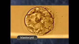 The Biology of Prenatal Development  Morula and Blastocyst [upl. by Dnomde628]