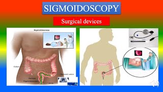 SIGMOIDOSCOPY Definition  parts uses  Precautions How to use   Surgical Devices [upl. by Katusha]