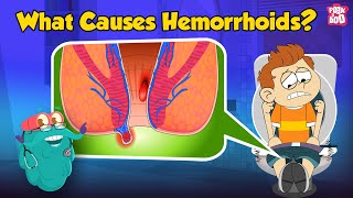 What are Piles  What Causes Hemorrhoids  Hemorrhoids Symptoms and Prevention  Dr Binocs Show [upl. by Hersh]