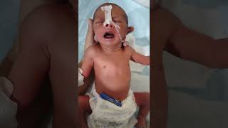 First cry baby baby nicu childbirth viralvideo cutebaby [upl. by Jereld]