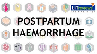 Prevention and Treatment of Postpartum Haemorrhage [upl. by Pace]