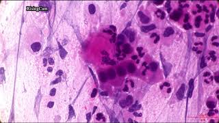 Microscope Camera Comparison of Omax 18mp vs RisingCam Sony IMX572 Sputum Smear HampE stained 4K [upl. by Perren423]