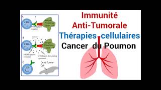 Cancer du Poumon Réponse de lImmunité AntiTumorale Thérapie cellulaire [upl. by Florin]