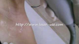 Laser Hair Removal arms pits [upl. by Panther]