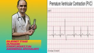 VENTRICULAR PREMATURE BEAT BY DRSUMIT TYAGISUMITMEDICALDISPENSARY1 [upl. by Akired666]