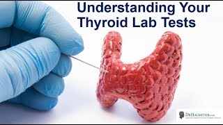 Understanding Your Thyroid Lab Ranges Everything You Need To Know about Your Thyroid labs [upl. by Sinnard]