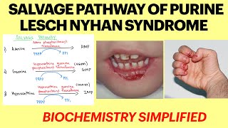 Salvage pathway of purines  Lesch nyhan syndrome  Purine metabolism  Biochemistry 1st yr MBBS [upl. by Anelagna]