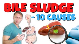 What Causes Poor Bile Flow and Gallbladder Sludge [upl. by Cohligan]