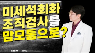 미세석회화 조직검사 맘모톰으로 가능합니다 [upl. by Quill]