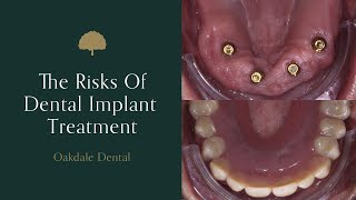 The Risks Of Dental Implant Treatment [upl. by Ardnahcal]