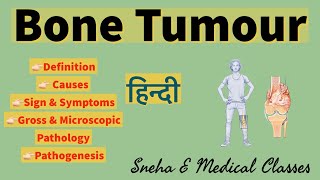 Bone Tumour  Pathology  Hindi [upl. by Eixam]