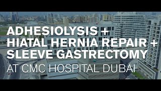 Adhesiolysis Hiatal Hernia Repair amp Sleeve Gastrectomy in Dubai  Dr Abdul Kader Weiss [upl. by Ornstead]