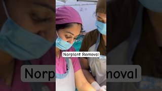 Norplant Removal — Full video click above👆🏻 contraceptives birthcontrol norplant shorts [upl. by Vale]