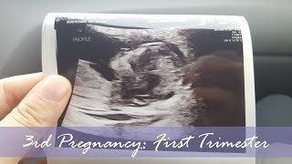 3rd Pregnancy First Trimester  Sickness Ultrasound and Maternity Clothes [upl. by Estrella239]