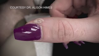 Bacteria viruses and fungus among health risks lurking at the nail salon [upl. by Deraj572]