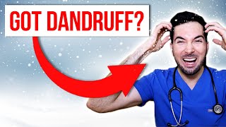 How to get rid of dandruff permanently at home and treatment [upl. by Dnarb563]