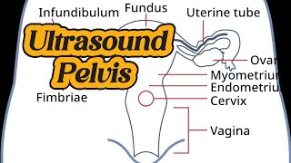 Ultrasound Endometritis  Cervicitis  Ovarian Cyst  Endometrium polyp  Thick Endometrium [upl. by Langelo]