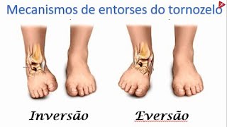 ENTORSE DE TORNOZELO  COMO PREVENIR [upl. by Walton253]