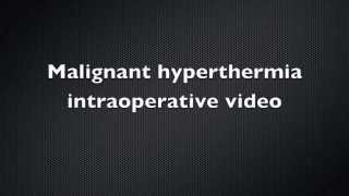 Malignant Hyperthermia Intraoperative video  Case Report [upl. by Taro]