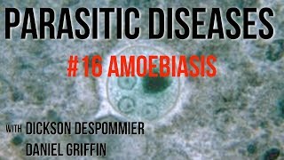 Parasitic Diseases Lectures 16 Amoebiasis [upl. by Htebazle]