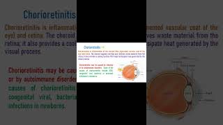 Chorioretinitis  Inflammation of Choroid and Retina [upl. by Ahsiekar]