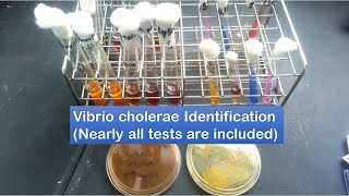 Vibrio cholerae identification  A to Z tests [upl. by Anetsirhc352]