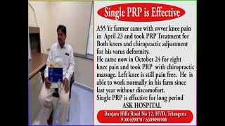 Single PRP is Effective [upl. by Germayne893]