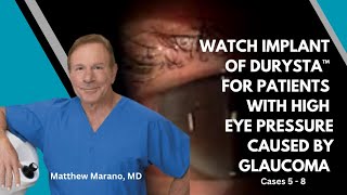 Watch implant of DURYSTA™ for patients with high eye pressure caused by glaucoma cases 5  8 [upl. by Leciram]