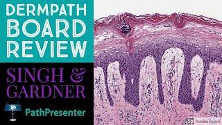 Dermpath Board Review 100 Classic Cases [upl. by Bernete]