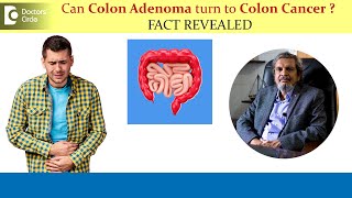 Can Colon Adenoma turn to Colon Cancer  Colon Polyp Removal Dr Rajasekhar M R  Doctors Circle [upl. by Latif]