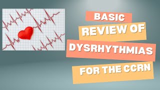 Rhythm Revelations Mastering Basic Dysrhythmia Interpretation [upl. by Gelhar]