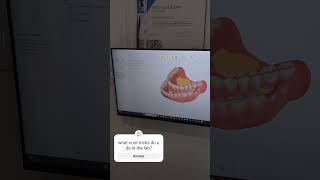 Using pin tracers How to make life easier meditdesign digitaldentures [upl. by Ivett]