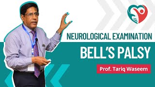 Bells Palsy  Neurological Examination by ProfTariqWaseem medical education medicalexamination [upl. by Suirtimed]