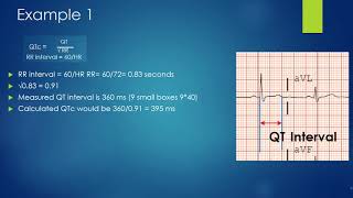 How to properly calculate a Qtc [upl. by Meerak]