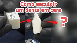 Esculpindo dente em cera  Parte 1 [upl. by Auvil]